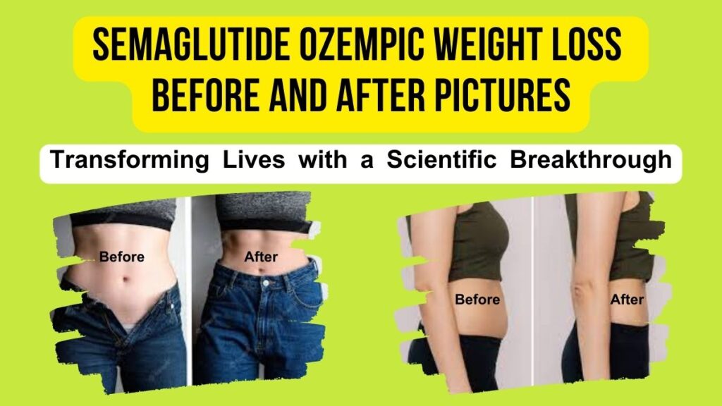 Semaglutide Ozempic Weight Loss Before and After Pictures